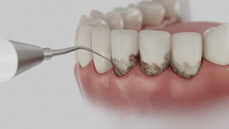 Trusted Teeth Whitening service in Robert Lee, TX - Dentist Open Now